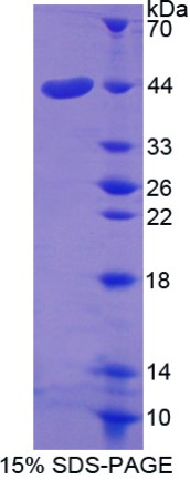 SDS PAGE (SERPINE2-8004H).jpg
